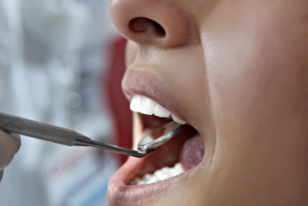 Dentist in Walnut Creek performing a routine dental checkup