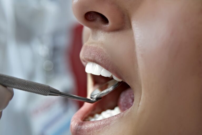 Dentist in Walnut Creek performing a routine dental checkup