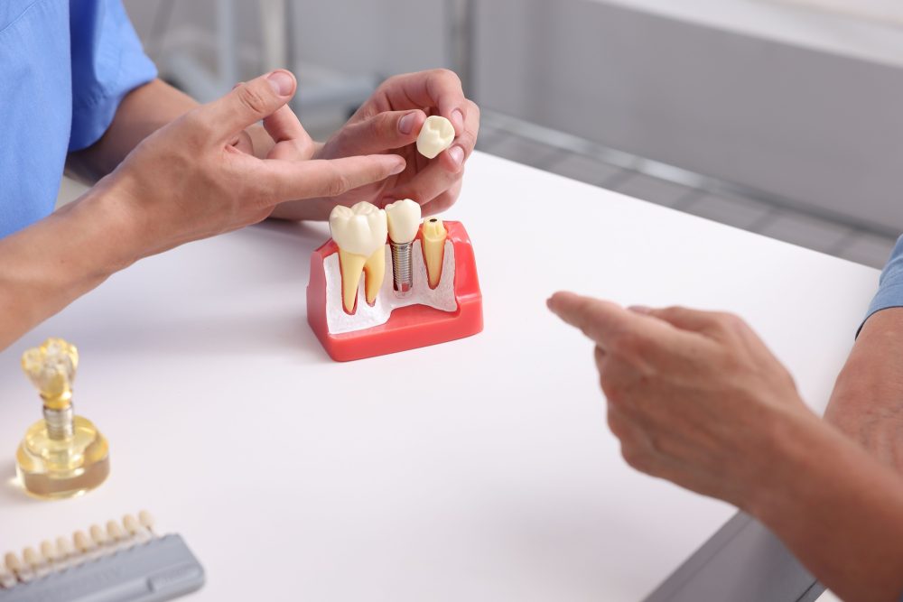 Dentist comparing dental crowns and fillings for a patient in Walnut Creek